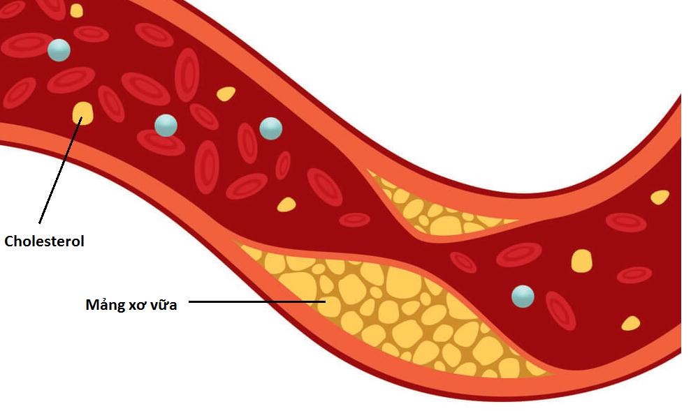 Cholesterol